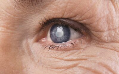 Comment éviter et prévenir la cataracte ?