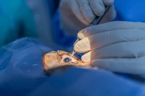 chirurgie cataracte ultrasons operation phacoemulsification ophtalmo paris specialiste chirurgie refractive chirurgie cataracte paris docteur romain nicolau