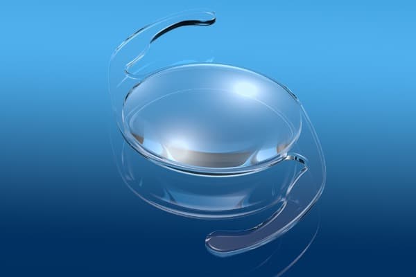 implant edof implant vision profondeur champ etendue ophtalmo paris specialiste chirurgie refractive chirurgie cataracte paris docteur romain nicolau