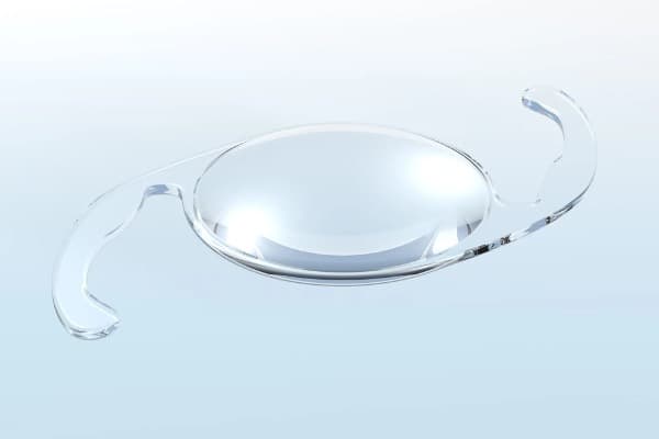 implant torique cataracte myopie chirurgie ophtalmo paris specialiste chirurgie refractive chirurgie cataracte paris docteur romain nicolau