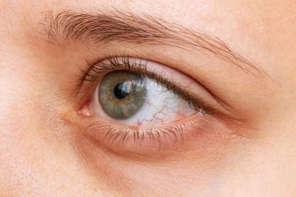 secheresse oculaire definition yeux secs symptomes ophtalmo paris specialiste chirurgie refractive chirurgie cataracte paris dr romain nicolau