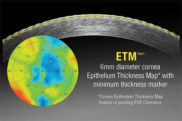 mapping epithelium cornee oeil lasik chirurgie refractive paris dr romain nicolau