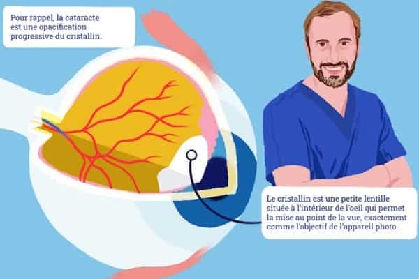 cataracte definition ophtalmo specialiste operation chirurgie cataracte paris que faire dr romain nicolau