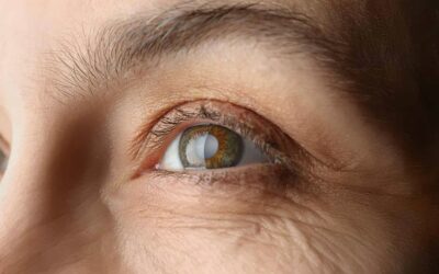 Quelles sont les suites après une opération de la cataracte ?