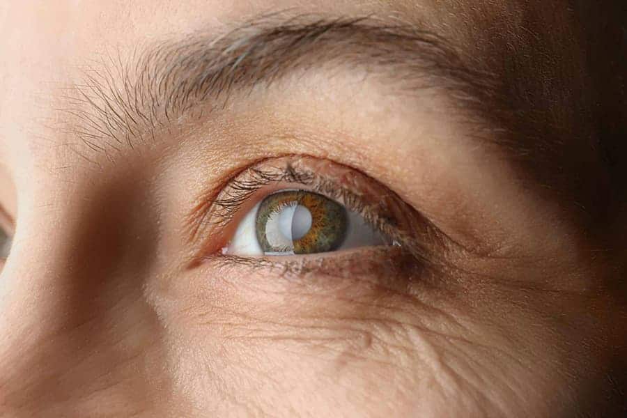 vision floue fatigue gene dans loeil apres suite operation cataracte convalescence operation cataracte paris dr romain nicolau paris