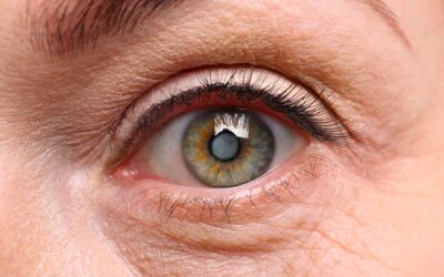 Quel est l’avantage des implants monofocaux pour la cataracte ?
